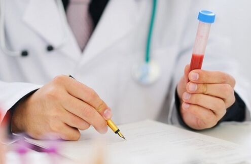 Prostatitis-Tests zur Verschreibung von Medikamenten
